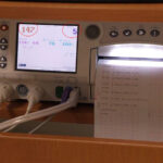 What Does the Toco Number Mean