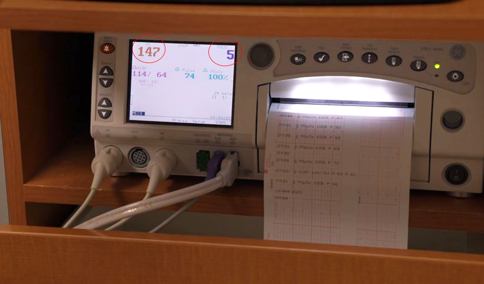 What Does the Toco Number Mean